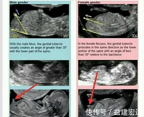 孕期头|孕期头4个月，定型的不止胎儿性别，还有这“三物”，孕妇要留心