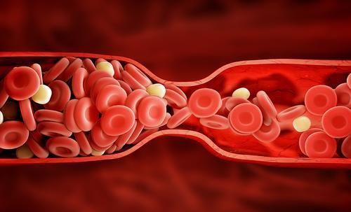 运动|老人多走路或有助于长寿?医生:60岁后,做好这3件事比运动重要