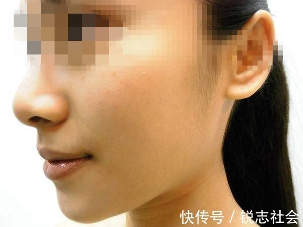 指甲|肝炎加重了伸开双手就知道,3变化及时检查,取冰箱2物养好肝