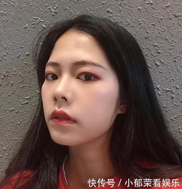 脸部|整容失败的“风险”有多大?额头凹陷、眼皮肉条,看完你还心动吗