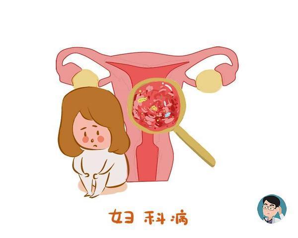 白带|女人妇科病的判断标准,医生不妨自测一下,看自己达不达标