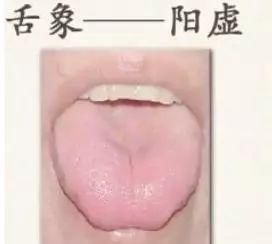  果你|免疫力是长寿关键，到底该如何加强自己免疫力？你的舌头知道答案