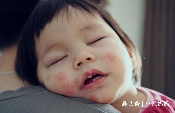 鸡蛋羹|儿科医生建议最好别给宝宝吃鸡蛋羹,还在喂的家长,需要注意