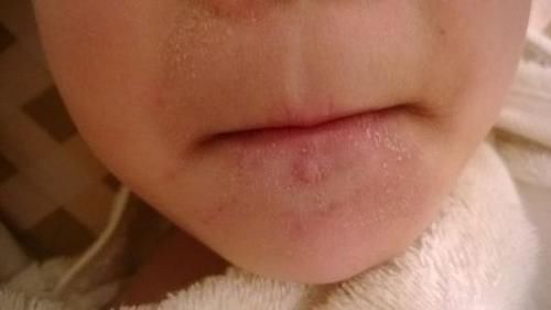 排便|母乳喂养的新生儿,喂水就没必要了吗?出现这些异常现象还是喂吧