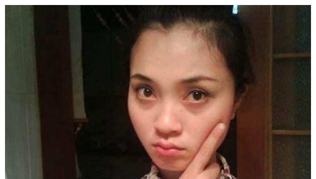 黑眼圈|女性有没有妇科病，看脸就知道！希望你没有这4个表现！