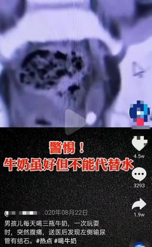 生长素|别折腾孩子了，这些关于孩子长高的谣言，你信了几个？