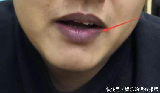 肝不好,若嘴巴有这3个“破绽”,或是提示你要养肝了,莫忽视