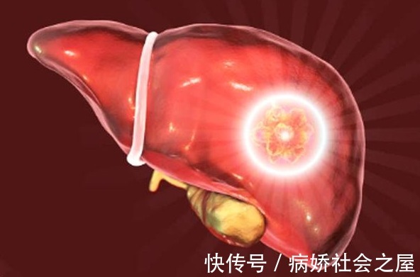 葛根|40岁后养肝就是续命!这4种护肝食物多吃点,肝脏会越来越红润