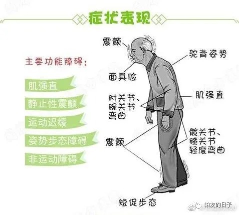 患者|帕金森中医上如何治疗呢?
