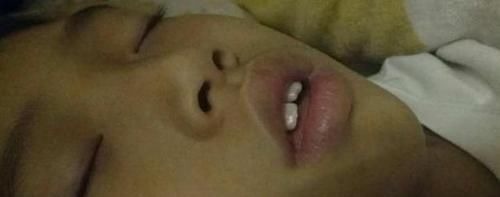 妈妈|儿子越长越像“大猩猩”,妈妈带去检查后,医生责问咋不早点来