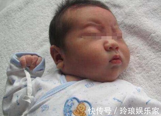 嵌合体|儿子DNA鉴定“叔叔”是亲爹,可老爸却是独生子,医生表示没错