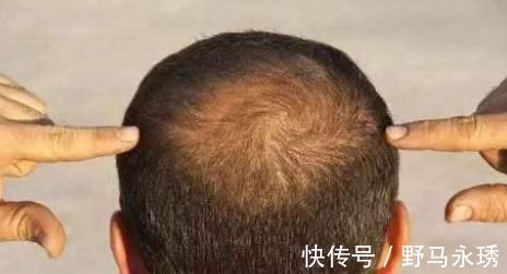 腰围|人开始衰老，身体会留下痕迹，教你3种对付办法，依然保持年轻态