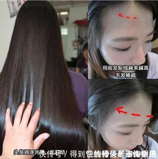 毛囊|头发刚打湿就抹洗发水难怪一天不洗就油头,分享正确的洗发方法