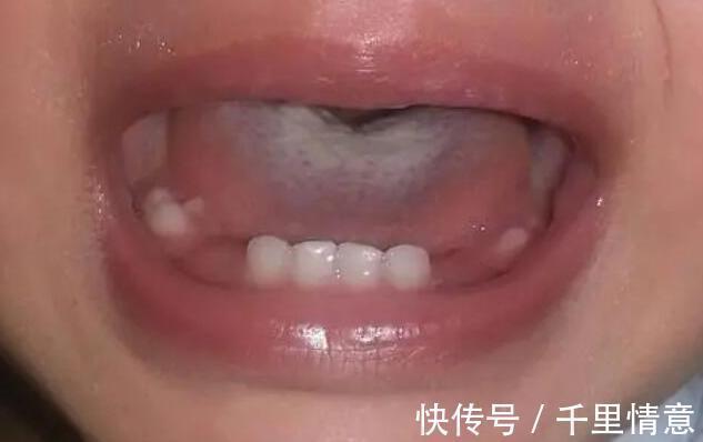 少年|初三少年一年长高19厘米,妇幼医生:这习惯很好,建议父母多学