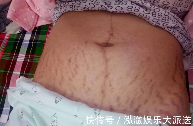 胎儿|怀孕5个月坚持健身,被胎儿“撑破”子宫身亡,丈夫泪目两行