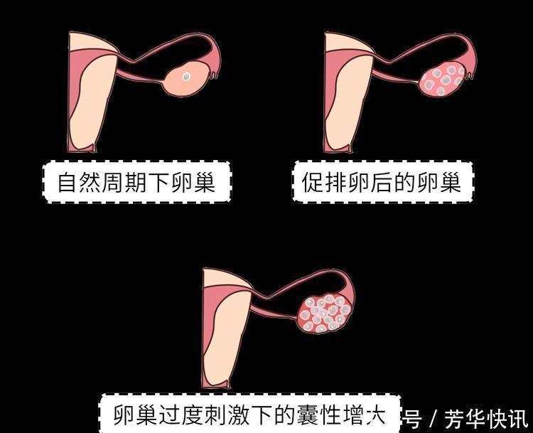 卵巢|女大学生“捐卵”还贷过程曝光，一次赚3.5万，最后肠子悔青了