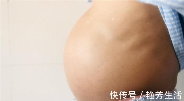 双胞胎|孕妇肚子的形状、大小、高低,代表了不同含义,准妈妈知道多少
