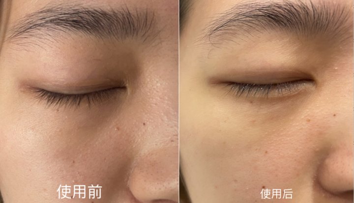 精准|功能型面膜VS补水面膜，精准和精简之间你选对了吗