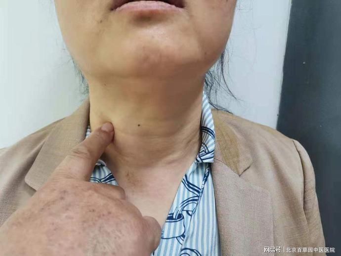 甲减|患甲减的人这么多,是什么原因导致的呢?