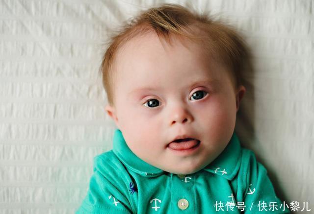 病症|宝妈发视频调侃儿子像“胡巴”,网友看后却急了:快送去医院检查