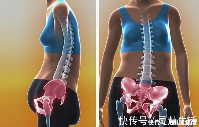 二胎|头胎选择剖腹产,二胎可以顺产吗?若孕妈是这三种情况,就别想了