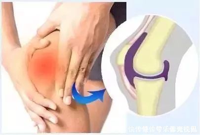 膝盖|夫妻双双手术换掉膝盖!罪魁祸首竟是坚持10年的“好习惯”!