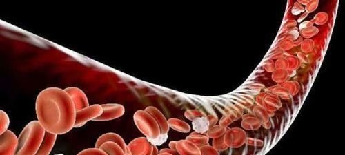 血管|血管的天然“清洁工”,每天吃一点,净化血液,血栓不敢“造次”