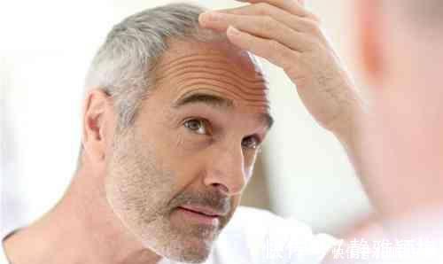 寸头|中老年男士白发越来越多,但染发的人越来越少,三个细节解读原因