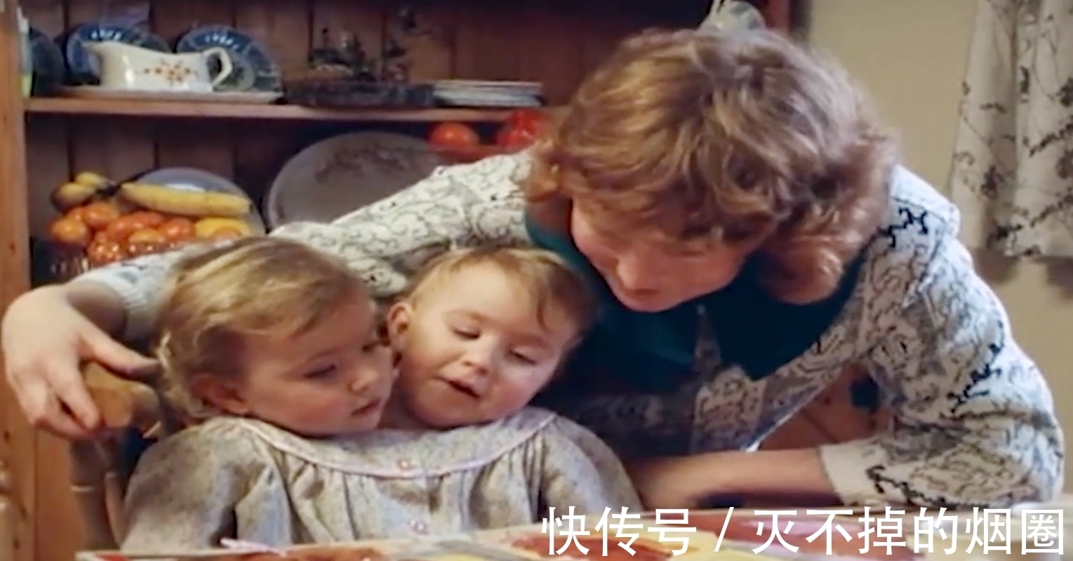 索菲亚|2女孩共用一个躯体生活3年,要将她们个体分离,能成功吗?