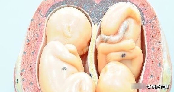 胎盘|孕期，为何有的孕妈不显怀，有的肚子大得像球？多半是3个原因