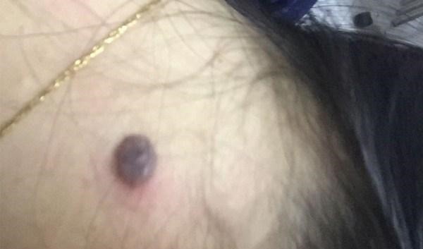 细胞|体内有了癌细胞，身体会发出什么信号若发现，别再拖着