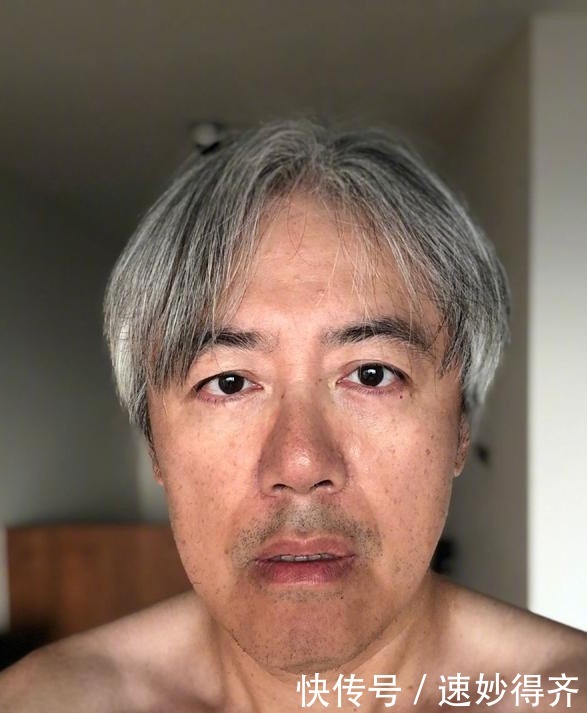 退圈2年 53岁张宇受遗传病困扰 近照已是满头白发 快资讯 退圈2年 53岁张宇受遗传病困扰 近照已是满头白发 快资讯