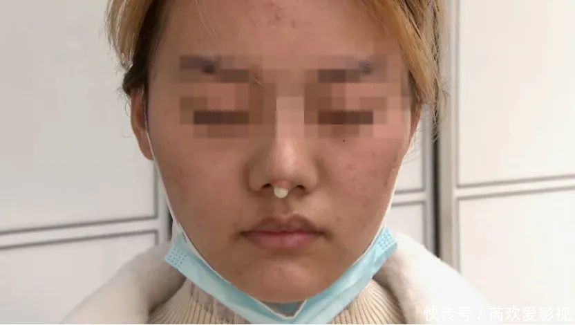 漂亮姑娘刚怀孕,鼻尖出现神秘白色物体!婆婆追问下,她瞒不住了…