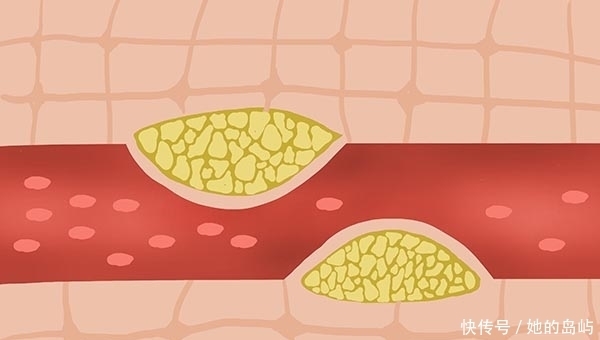 一天吃一个鸡蛋好不好?胆固醇高,可以吃吗?国内外研究给出答案