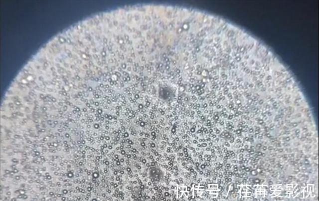 母乳喂养|把母乳放在显微镜下,竟然是“活的”,会微微蠕动