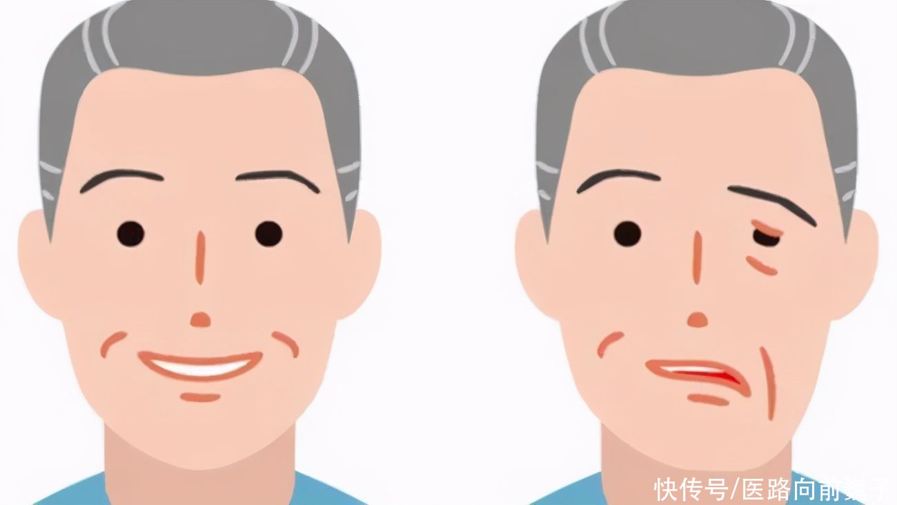 潜伏期|每年100万人死于此病！医生：身上的伤口别这样处理