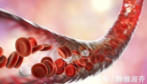 血脂|高血压最怕血管出问题,如何防治,有4点要求!每个患者都该知道