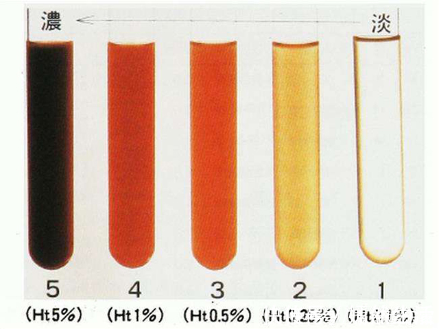 征兆|身体突然出现的这些征兆！是预示“大病”来临，大多数人都不知道