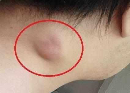 指甲|身体如果出现3种现象,说明癌症可能找上你了,尽早检查