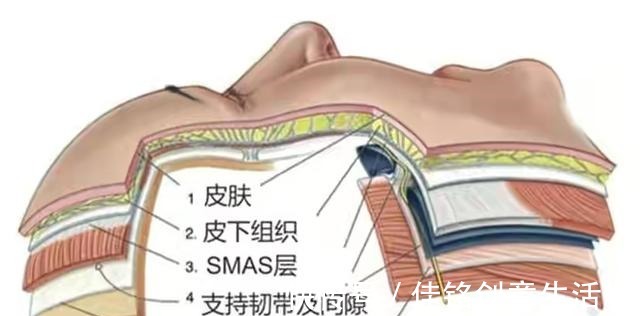 线雕隆鼻 盘点当下“热门医美项目”的几个真相(有些弯路不能走)!