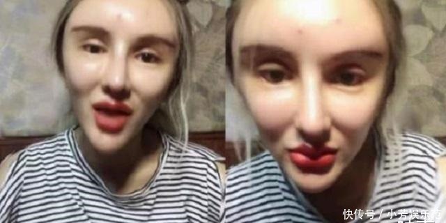 鲁豫有约|“粉红宝宝”为了美13年整形200多次,如今只能坐在轮椅上