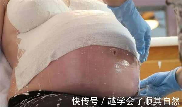 模型师|母亲用石膏包住自己怀了9个月大的肚子,她的动机让世人点赞!
