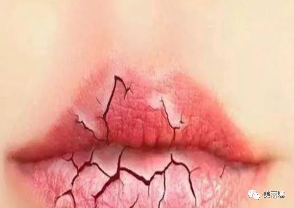 口红|有多少女孩不会涂口红,还天天顶着一嘴姨妈色还认为自己挺美