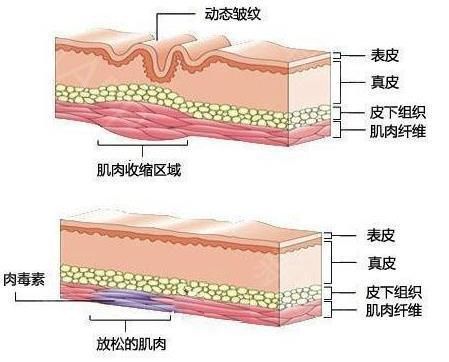 解救“大龄”眼周问题，这篇给你一次搞定