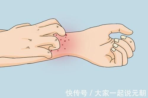 规则性|皮肤下面长出大包,是癌症信号?医生哭笑不得:满足3点才有可能