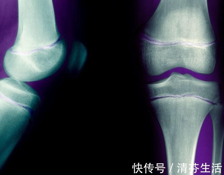 钙质|孩子进入猛长期,家长不要错过“3个信号”,多长1公分也是好事