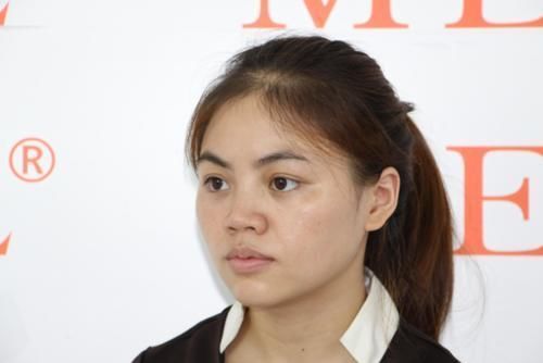 皮肤科|28岁女子因常吃一“零嘴”,皮肤慢慢变白,皮肤科医生:值得借鉴