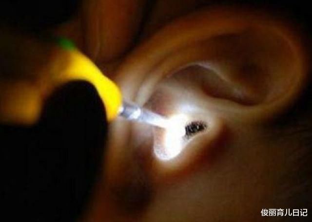 孩子|男童半夜耳朵疼,妈妈拿灯一照马上去医院,回家立刻丢东西