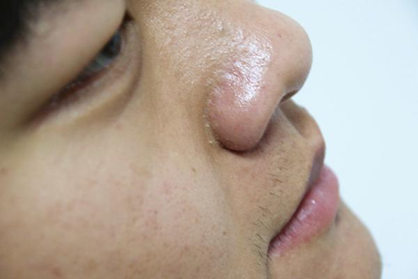 男性|雄激素干涸的男性,会怎样多吃天然雄激素食物,提升男人味