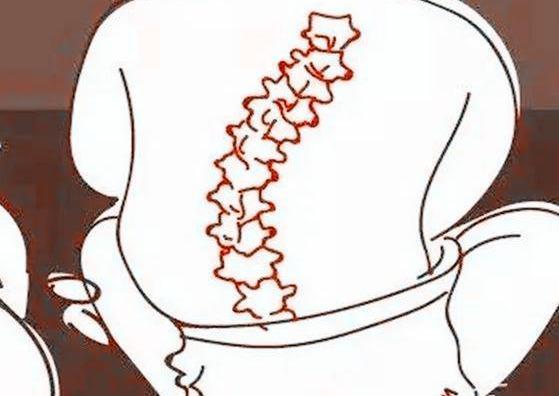 豆豆|新晋宝妈晒宝宝搞怪睡姿照,朋友评论孩子有问题,快带去检查下